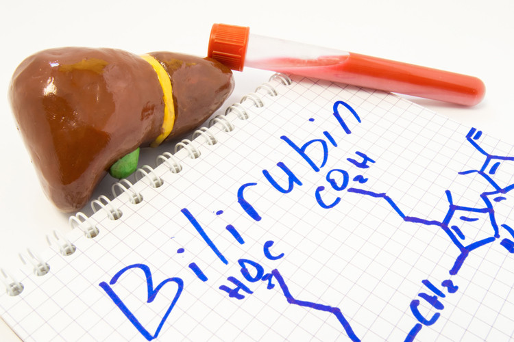 How To Lower Bilirubin: A Practitioner’s Guide To Healthier Counts