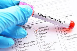 cortisol-blood-test