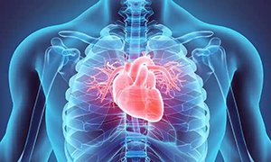 edema-of-cardiac-origin