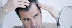 hair-loss-treatment