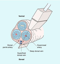 ultrasound-exam-of-penis
